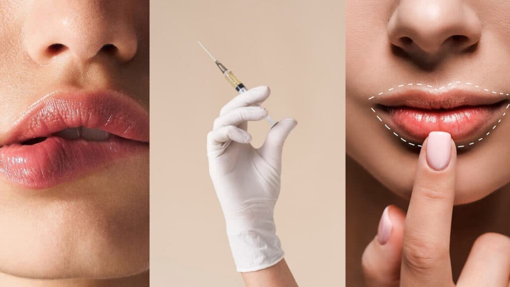 Medikal Estetikte Yeni Dönem: Biyostimülan yaklaşımla daha doğal dudaklar