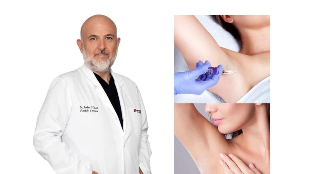 Dr Serhat Totan ve koltukaltı botoks uygulaması ile ilgili görseller