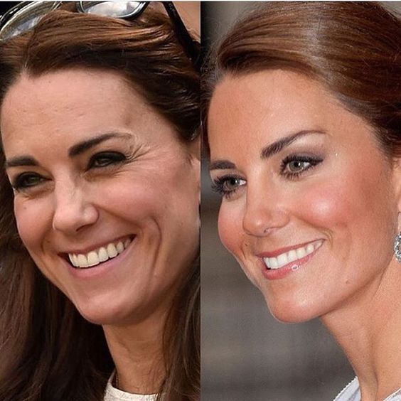 Kate Middleton'ın doğal ve pürüzsüz cilt görünümü karşılaştırması