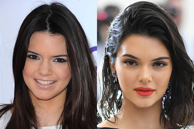 Kendall Jenner'ın önce ve sonraki makyajlı ve doğal hali karşılaştırması