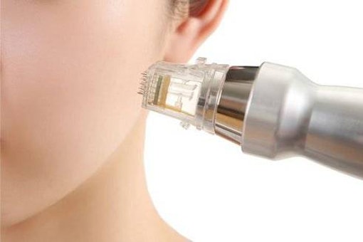 Yüzüne microneedling cihazı ile estetik cilt tedavisi yaptıran bir kadın