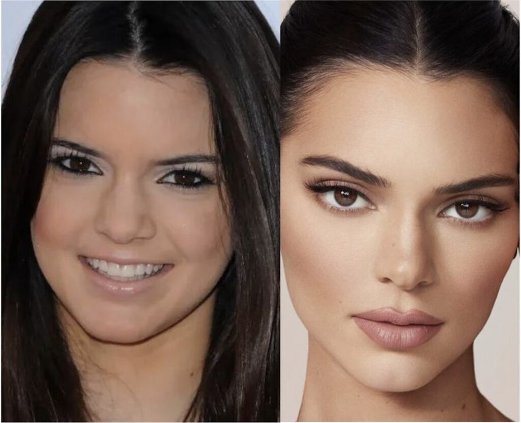 Kendall Jenner'ın gençlik ve güncel görünümünü karşılaştıran iki fotoğraf